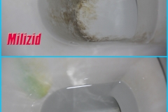 HIGA-Doszczyszczanie-toalety-Dr.-Schnell-MILIZID